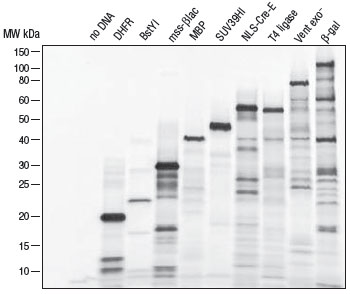 Figure 2: Incorporation of 35S-methionine enables visualizationof protein by autoradiography. 