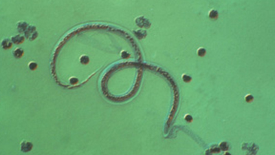 Parasitology_FA_CombatingNeglectedDiseases_thumb