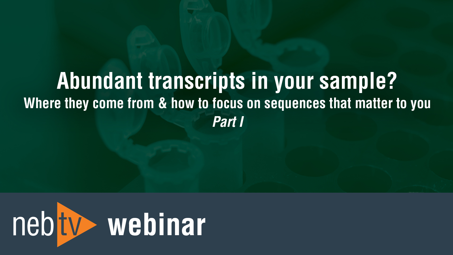 Abundant-transcripts-in-your-sample-Part1
