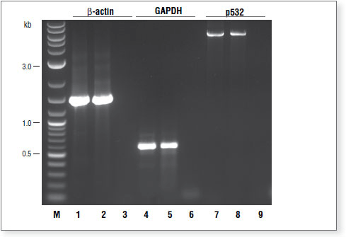 Figure 1. First Strand DNA Synthesis 